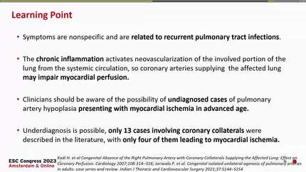 Left pulmonary artery hypoplasia: a rare cause of severe left ventricular systolic dysfunction