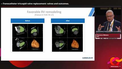 Presentation thumbnail