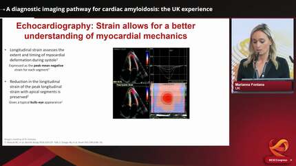 Cardiac amyloidosis: overlooked and undertreated – UK and Ireland