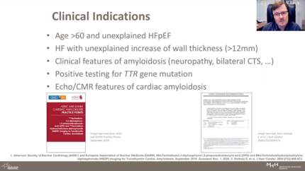 Diagnosis of Cardiac Amyloidosis Using Non-Invasive Technics