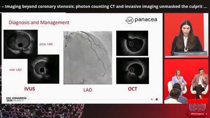 Imaging beyond coronary stenosis: photon counting CT  and invasive imaging unmasked the culprit lesion in an NSTEMI patient.