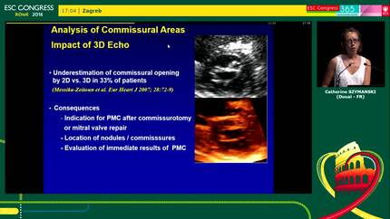 Presentation thumbnail