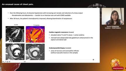 An unusual cause of chest pain.