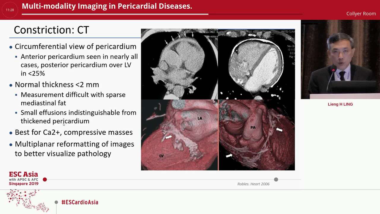 Multi-modality Imaging in Pericardial Diseases.