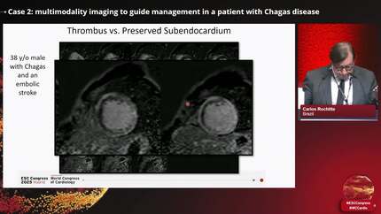 Clinical Case Management: how multimodality imaging guides management in inflammatory cardiomyopathy