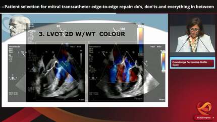 Presentation thumbnail