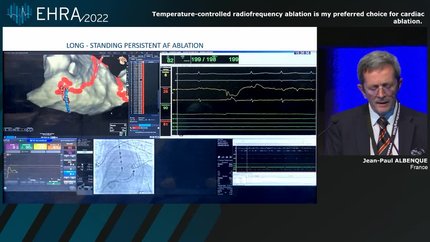 Temperature-controlled radiofrequency ablation is my preferred choice for cardiac ablation.