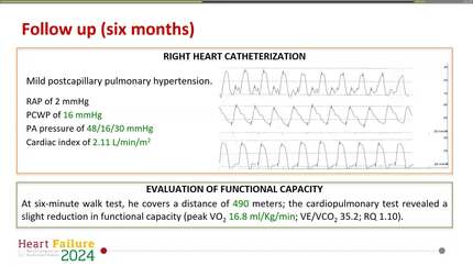 Is there enough room in the LVAD bag for the four pillars of heart failure therapy?