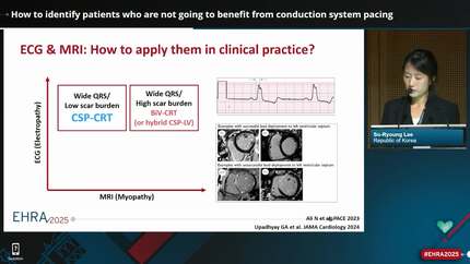 How to identify patients who are not going to benefit from conduction system pacing