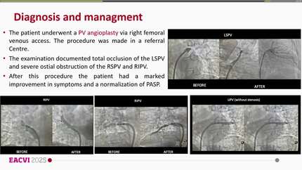 Presentation thumbnail