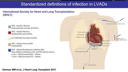 CIED / LVAD