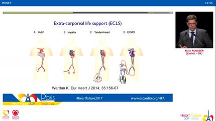 When drugs alone are not enough - Mechanical circulatory support