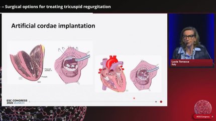 Presentation thumbnail