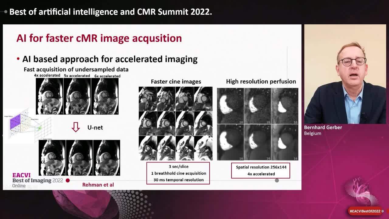 Best of artificial intelligence and CMR Summit 2022.