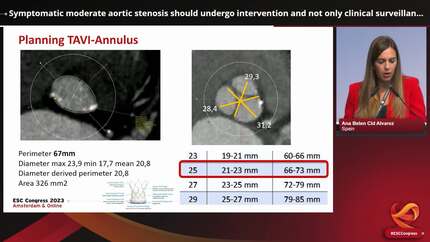 Great Debate: symptomatic moderate aortic stenosis - to intervene or not to intervene?