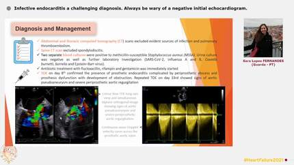 Infective endocarditis a challenging diagnosis. Always be wary of a negative initial echocardiogram.
