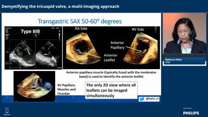 Challenging the standard workflow in cardiology imaging​