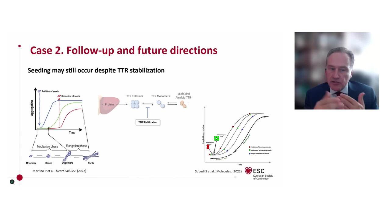 New drugs in the treatment of amyloidosis