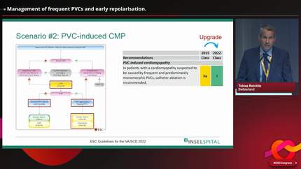 The young patient with arrhythmia: management of mitral valve prolapse, frequent PVCs and early repolarisation