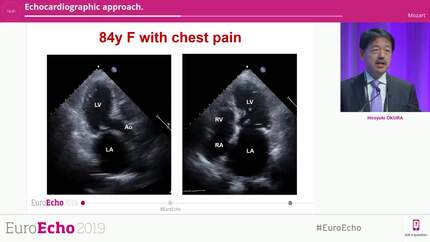 Echocardiographic approach.
