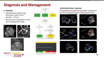 Presentation thumbnail