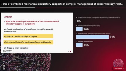 Use of combined mechanical circulatory supports in complex management of cancer therapy-related cardiogenic shock 