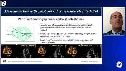Presentation thumbnail