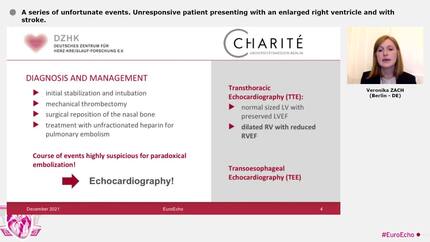 A series of unfortunate events. Unresponsive patient presenting with an enlarged right ventricle and with stroke.