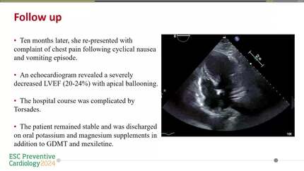 Recurrent Takutsobo cardiomyopathy secondary to cyclical vomiting syndrome