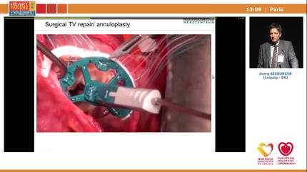 Presentation thumbnail