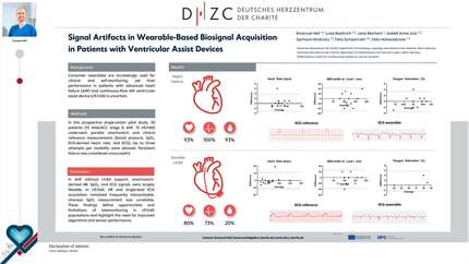 Signal artifacts in wearable-based biosignal acquisition in patients with ventricular assist devices