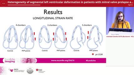 Heterogeneity of segmental left ventricular deformation in patients with mitral valve prolapse as potential substrate of ventricular arrhythmias