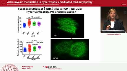 Actin-myosin modulation in hypertrophic and dilated cardiomyopathy