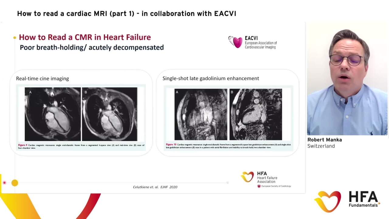 HFA Fundamentals+ How to: Read a cardiac MRI (part 1)