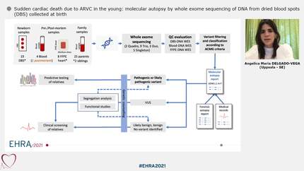 Sudden cardiac death due to ARVC in the young: molecular autopsy by whole exome sequencing of DNA from dried blood spots (DBS) collected at birth