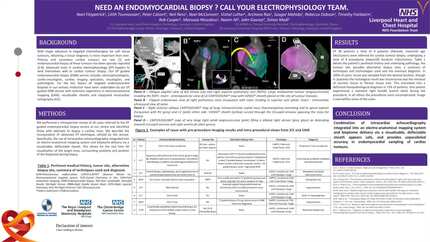 Need an endomyocardial biopsy? Call your electrophysiology team.