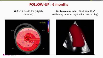 Presentation thumbnail