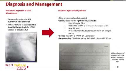 Presentation thumbnail
