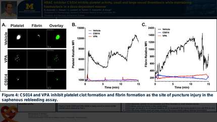 HDAC inhibitor CS014 inhibits platelet activity, small and large vessel thrombosis while maintaining haemostasis in a dose-dependent manner