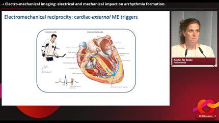 Imaging cellular interaction in arrhythmias to identify novel therapeutic targets