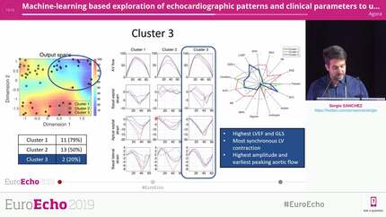 Machine-learning based exploration of echocardiographic patterns and clinical parameters to understand their relation to death or transplant in pediatric dilated cardiomyopathy