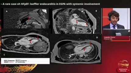 Presentation thumbnail