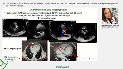 Can isometric effort correlated with other cardiovascular risk factors underlie the occurrence of aortic aneurysm complicated by aortic dissection?
