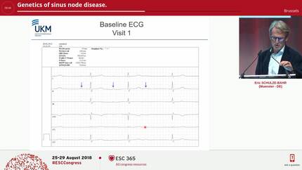 Genetics of sinus node disease.
