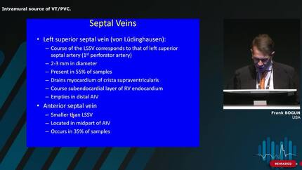 How to perform challenging idiopathic ventricular tachycardia (VT)/premature ventricular contractions (PVC) ablation