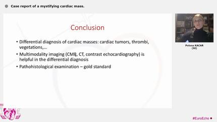 Case report of a mystifying cardiac mass.