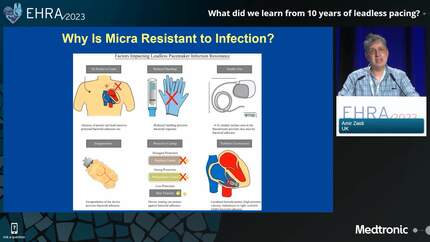 Innovations in cardiac rhythm management: from leadless devices to artificial intelligence