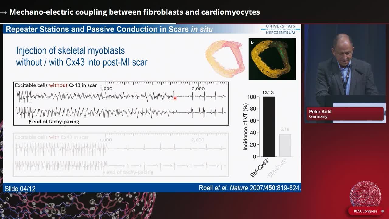 Causes and consequences of cardiac fibrosis