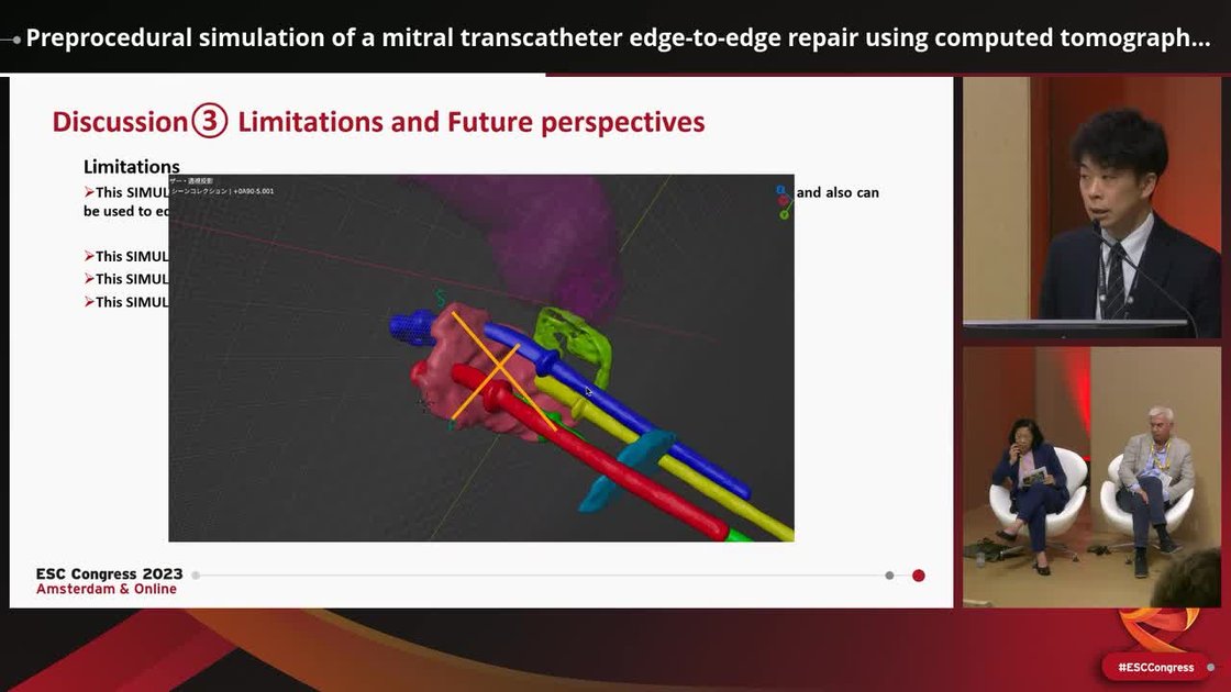 ESC 365 - Preprocedural simulation of a mitral transcatheter edge-to ...
