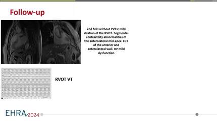 Presentation thumbnail